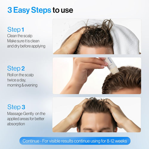 Rosemary Hair Growth Serum Roll-On (25 ml)